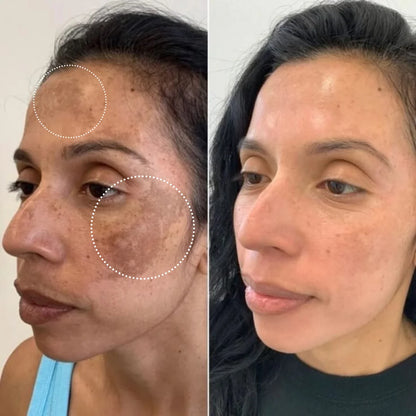 Sérum Despigmentante Vitamina C + Niacinamida