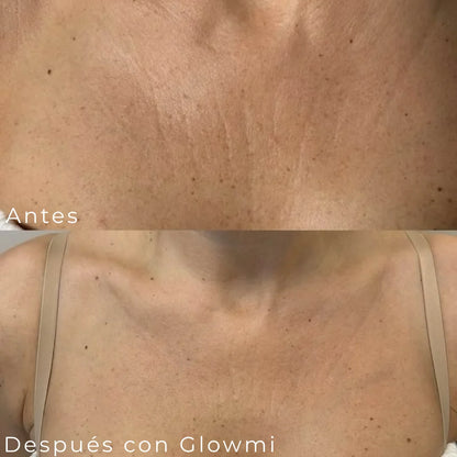 locion de de retinol