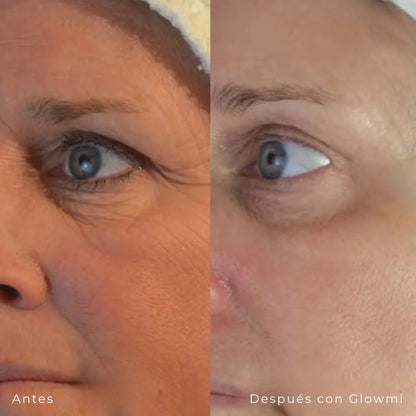 locion de de retinol