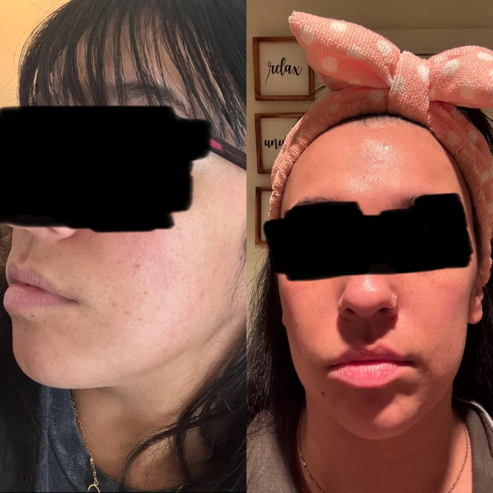 <h2>Resultados de nuestras chicas</h2>