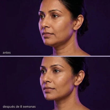 Glowmi™ | Crema reafirmante de Cuello y Mandíbula