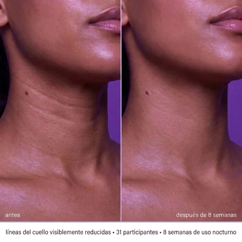 Glowmi™ | Crema reafirmante de Cuello y Mandíbula