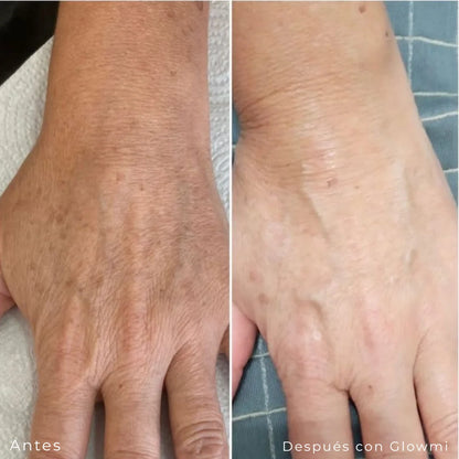 locion de de retinol