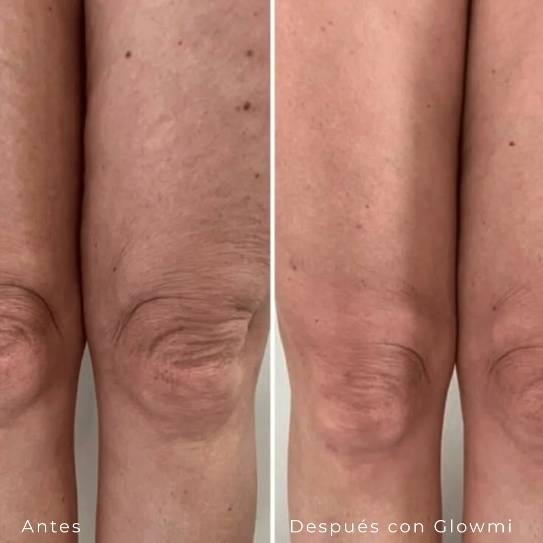 locion de de retinol