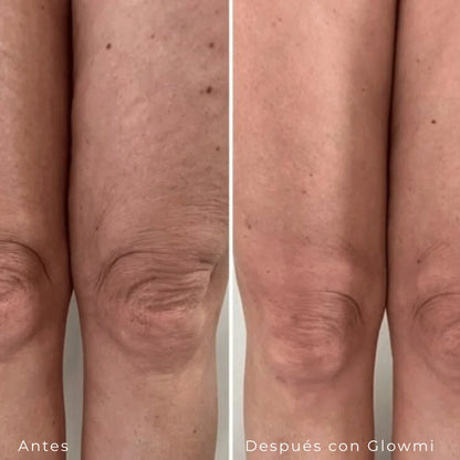 locion de de retinol